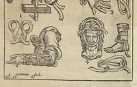 Picture 18 of 30 from L'Oeconomie chirurgicale, pour le r'habillement des os du corps humain contenant l'ostéologie, la nososreologie, l'apocatastosteologie, & le Traitté des bandages (1671), leaf 400