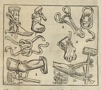 An illustration from L'Oeconomie chirurgicale, pour le r'habillement des os du corps humain contenant l'ostéologie, la nososreologie, l'apocatastosteologie, & le Traitté des bandages (1671)