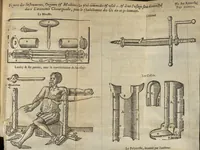 Picture 20 of 30 from L'Oeconomie chirurgicale, pour le r'habillement des os du corps humain contenant l'ostéologie, la nososreologie, l'apocatastosteologie, & le Traitté des bandages (1671), leaf 410