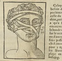 Picture 24 of 30 from L'Oeconomie chirurgicale, pour le r'habillement des os du corps humain contenant l'ostéologie, la nososreologie, l'apocatastosteologie, & le Traitté des bandages (1671), leaf 431