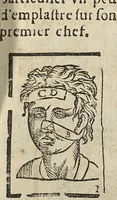 Picture 26 of 30 from L'Oeconomie chirurgicale, pour le r'habillement des os du corps humain contenant l'ostéologie, la nososreologie, l'apocatastosteologie, & le Traitté des bandages (1671), leaf 431