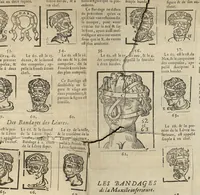 Picture 27 of 30 from L'Oeconomie chirurgicale, pour le r'habillement des os du corps humain contenant l'ostéologie, la nososreologie, l'apocatastosteologie, & le Traitté des bandages (1671), leaf 447