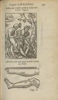 Picture 12 of 17 from Chirurgie françoise ... avec plusieurs figures des instrumens nécessaires pour l'opération manuelle (1610), leaf 446
