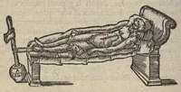 An illustration from Chirurgie françoise ... avec plusieurs figures des instrumens nécessaires pour l'opération manuelle (1610)