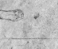 An illustration from Divi Hippocratis Coi Prognosticôn latina ecphrasis ex mente Galeni (1575)