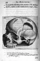 Picture 13 of 20 from Petri Paaw Amsteldamensis Succenturiatus Anatomicus. continens Commentaria in Hippocratem, de Capitis Vulneribus. additae In aliquot Capita libri VIII C. Celsi Explicationes. Ad illustres, Nobiles, Praepotentes, ac verè Magnifices Hollandiae Westfrisiaeque Ordines. (1616), leaf 103