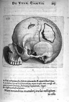 An illustration from Petri Paaw Amsteldamensis Succenturiatus Anatomicus. continens Commentaria in Hippocratem, de Capitis Vulneribus. additae In aliquot Capita libri VIII C. Celsi Explicationes. Ad illustres, Nobiles, Praepotentes, ac verè Magnifices Hollandiae Westfrisiaeque Ordines. (1616)
