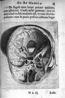 An illustration from A. Cornelii Celsi de Re Medica liber octavus. ejus priora quatuor Capita Commentariis illustrata a Petro Paaw (1616)