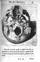 Picture 4 of 12 from A. Cornelii Celsi de Re Medica liber octavus. ejus priora quatuor Capita Commentariis illustrata a Petro Paaw (1616), leaf 22