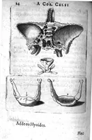 An illustration from A. Cornelii Celsi de Re Medica liber octavus. ejus priora quatuor Capita Commentariis illustrata a Petro Paaw (1616)