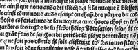 An illustration from La cyrurgie de maistre Guillaume de Salicet (1505)