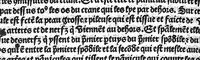An illustration from La cyrurgie de maistre Guillaume de Salicet (1505)