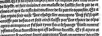 An illustration from La cyrurgie de maistre Guillaume de Salicet (1505)
