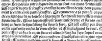 Picture 10 of 16 from Cy est Lanathomie de maistre Mundin boullonnoys, naguere traduicte de langue latine en vulgaire ou francoyse. Ou sont plusieurs figures et apostilles : moult requise et necessaire pour la congnoissance et notice dicelle/ Reveue et recongneue en plusieurs lieus par ledit translateur. Nouvellement imprimée (1532), leaf 66