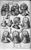 Picture 31 of 41 from Cheiroplotheke, seu... Armamentarium chirurgicum XLIII tabulis... exornatum. Opus posthumum... (1655), leaf 101