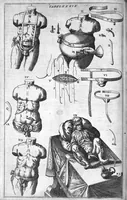 Picture 35 of 41 from Cheiroplotheke, seu... Armamentarium chirurgicum XLIII tabulis... exornatum. Opus posthumum... (1655), leaf 119