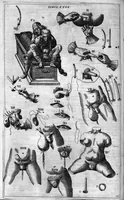 Picture 36 of 41 from Cheiroplotheke, seu... Armamentarium chirurgicum XLIII tabulis... exornatum. Opus posthumum... (1655), leaf 125