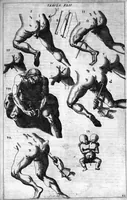 Picture 37 of 41 from Cheiroplotheke, seu... Armamentarium chirurgicum XLIII tabulis... exornatum. Opus posthumum... (1655), leaf 132