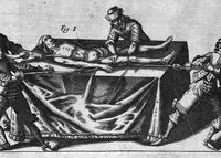 Picture 22 of 41 from Cheiroplotheke, seu... Armamentarium chirurgicum XLIII tabulis... exornatum. Opus posthumum... (1655), leaf 64