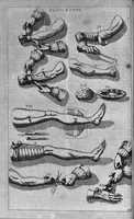 Picture 25 of 41 from Cheiroplotheke, seu... Armamentarium chirurgicum XLIII tabulis... exornatum. Opus posthumum... (1655), leaf 67