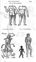 An illustration from Les Oeuvres d’Ambroise Paré, conseiller et premier chirurgien du roy, divisées en vingt-sept livres : avec les figures et portraicts tant de l’Anatomie que des instruments de chirurgie et de plusieurs monstres : reveuz et augmentez par l’autheur pour la seconde Edition, Paris, (1579)