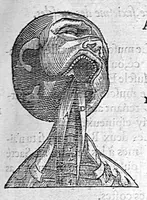 An illustration from Les Oeuvres d’Ambroise Paré, conseiller et premier chirurgien du roy, divisées en vingt-sept livres : avec les figures et portraicts tant de l’Anatomie que des instruments de chirurgie et de plusieurs monstres : reveuz et augmentez par l’autheur pour la seconde Edition, Paris, (1579)