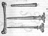 An illustration from Les Oeuvres d’Ambroise Paré, conseiller et premier chirurgien du roy, divisées en vingt-sept livres : avec les figures et portraicts tant de l’Anatomie que des instruments de chirurgie et de plusieurs monstres : reveuz et augmentez par l’autheur pour la seconde Edition, Paris, (1579)