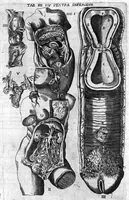 Picture 2 of 7 from Oeuvres de chirurgie (1649), leaf 141