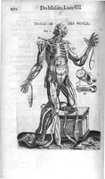 An illustration from Oeuvres de chirurgie (1649)