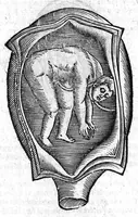 An illustration from Oeuvres de chirurgie (1649)