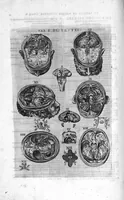 Picture 35 of 38 from Tables anatomiques avec les pourtraicts et declaration d'iceulx ensemble un denombrement de cinq cens maladies diverses, au Roy par Jac. Guillemeau d’Orleans, Chirurgien du Roy et Juré a Paris, [suivi de] Anatomie universelle du corps humain en tables methodiques. Avec les portraicts et figures de chacune des parties et declaration d’icelles. Divisee en sept livres ensemble un denombrement de cinq cens maladies diverses. Au Roy par Jaques Guillemeau, chirurgien du roy, et jure a Paris, (1586), leaf 115