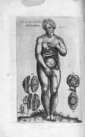 Picture 29 of 38 from Tables anatomiques avec les pourtraicts et declaration d'iceulx ensemble un denombrement de cinq cens maladies diverses, au Roy par Jac. Guillemeau d’Orleans, Chirurgien du Roy et Juré a Paris, [suivi de] Anatomie universelle du corps humain en tables methodiques. Avec les portraicts et figures de chacune des parties et declaration d’icelles. Divisee en sept livres ensemble un denombrement de cinq cens maladies diverses. Au Roy par Jaques Guillemeau, chirurgien du roy, et jure a Paris, (1586), leaf 89