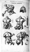 Picture 18 of 21 from Cheiroplotheke, seu... Armamentarium chirurgicum XLIII tabulis... exornatum. Opus posthumum... (1656), leaf 153