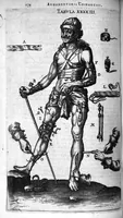 Picture 20 of 21 from Cheiroplotheke, seu... Armamentarium chirurgicum XLIII tabulis... exornatum. Opus posthumum... (1656), leaf 191