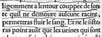 An illustration from La chirurgie de Paulus Aegineta. Qui est le sixiesme livre de ses Oeuvres. Item ung Opuscule de Galien, des tumeurs contre nature. Plus ung Opuscule dudict Galien, de la maniere de curer par abstraction de sang. Le tout traduict de Latin en Françoys par Maistre Pierre Tolet Medecin de l’Hospital de Lyon, (1540)