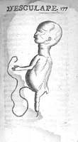 An illustration from Le Temple d'Esculape, ou le Dépositaire des nouvelles découvertes qui se font journellement dans toutes les parties de la médecine / ... recueillies... par Nicolas de Blégny,... (1680)
