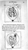 An illustration from Le propagatif de l’homme et secours des femmes en travail d’enfant,utiles & necessaire à toutes personnes. Enrichy de figures (1623)