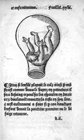 Picture 7 of 12 from Des divers travaulx et enfantemens des femmes, et par quel moyen lon doit survenir aux accidens qui peuvent escheoir devant et apres iceulx travaulx. Item quel lait et quelle nourrisse on doit eslire aux enfans : ensemble aucuns remedes concernens plusieurs maladies survenantes ausdits enfans nouveaux nez. Livret fort utile et duysant pour survenir a beaucoup de necessitez. Compose premierement en latin, par excellent medicin de Francfort, maistre Euchaire Rodion, et depuis tourne en langue françoyse, a lutilite de plusieurs personnes (1536), leaf 50