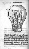 An illustration from Des divers travaulx et enfantemens des femmes, et par quel moyen lon doit survenir aux accidens qui peuvent escheoir devant et apres iceulx travaulx. Item quel lait et quelle nourrisse on doit eslire aux enfans : ensemble aucuns remedes concernens plusieurs maladies survenantes ausdits enfans nouveaux nez. Livret fort utile et duysant pour survenir a beaucoup de necessitez. Compose premierement en latin, par excellent medicin de Francfort, maistre Euchaire Rodion, et depuis tourne en langue françoyse, a lutilite de plusieurs personnes (1536)