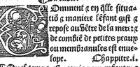 An illustration from Des divers travaulx et enfantemens des femmes, et par quel moyen lon doit survenir aux accidens qui peuvent escheoir devant et apres iceulx travaulx. Item quel lait et quelle nourrisse on doit eslire aux enfans : ensemble aucuns remedes concernens plusieurs maladies survenantes ausdits enfans nouveaux nez. Livret fort utile et duysant pour survenir a beaucoup de necessitez. Compose premierement en latin, par excellent medicin de Francfort, maistre Euchaire Rodion, et depuis tourne en langue françoyse, a lutilite de plusieurs personnes (1536)