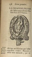 An illustration from L'accoucheur methodique, qui enseigne la maniere d'operer dans tous les accouchements naturels et artificiels... (1676)