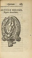 An illustration from L'accoucheur methodique, qui enseigne la maniere d'operer dans tous les accouchements naturels et artificiels... (1676)