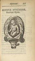 An illustration from L'accoucheur methodique, qui enseigne la maniere d'operer dans tous les accouchements naturels et artificiels... (1676)
