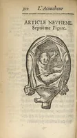 An illustration from L'accoucheur methodique, qui enseigne la maniere d'operer dans tous les accouchements naturels et artificiels... (1676)
