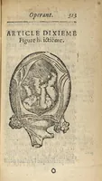 Picture 21 of 28 from L'accoucheur methodique, qui enseigne la maniere d'operer dans tous les accouchements naturels et artificiels... (1676), leaf 344