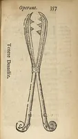 An illustration from L'accoucheur methodique, qui enseigne la maniere d'operer dans tous les accouchements naturels et artificiels... (1676)