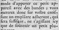An illustration from L' appareil commode en faveur des jeunes chirurgiens (1700)