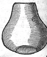 An illustration from Deux livres de chirurgie, I. De la generation de l’homme, et maniere d’extraire les enfans hors du ventre de la mere, ensemble ce qu’il faut faire pour la faire mieux, et plus tost accoucher, avec la cure de plusieurs maladies qui luy peuvent survenir. 2. Des monstres tant terrestres que marins, avec leurs portrait. Plus un petit traité des plaies faites aux parties nerveuses. Par Ambroise Paré, premier Chirurgien du Roy, et juré à Paris, (1573)