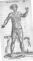 An illustration from Deux livres de chirurgie, I. De la generation de l’homme, et maniere d’extraire les enfans hors du ventre de la mere, ensemble ce qu’il faut faire pour la faire mieux, et plus tost accoucher, avec la cure de plusieurs maladies qui luy peuvent survenir. 2. Des monstres tant terrestres que marins, avec leurs portrait. Plus un petit traité des plaies faites aux parties nerveuses. Par Ambroise Paré, premier Chirurgien du Roy, et juré à Paris, (1573)