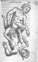 An illustration from Deux livres de chirurgie, I. De la generation de l’homme, et maniere d’extraire les enfans hors du ventre de la mere, ensemble ce qu’il faut faire pour la faire mieux, et plus tost accoucher, avec la cure de plusieurs maladies qui luy peuvent survenir. 2. Des monstres tant terrestres que marins, avec leurs portrait. Plus un petit traité des plaies faites aux parties nerveuses. Par Ambroise Paré, premier Chirurgien du Roy, et juré à Paris, (1573)